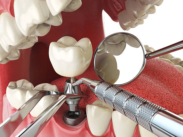 Best Cosmetic Emergency Dentistry in Sugarcreek, OH